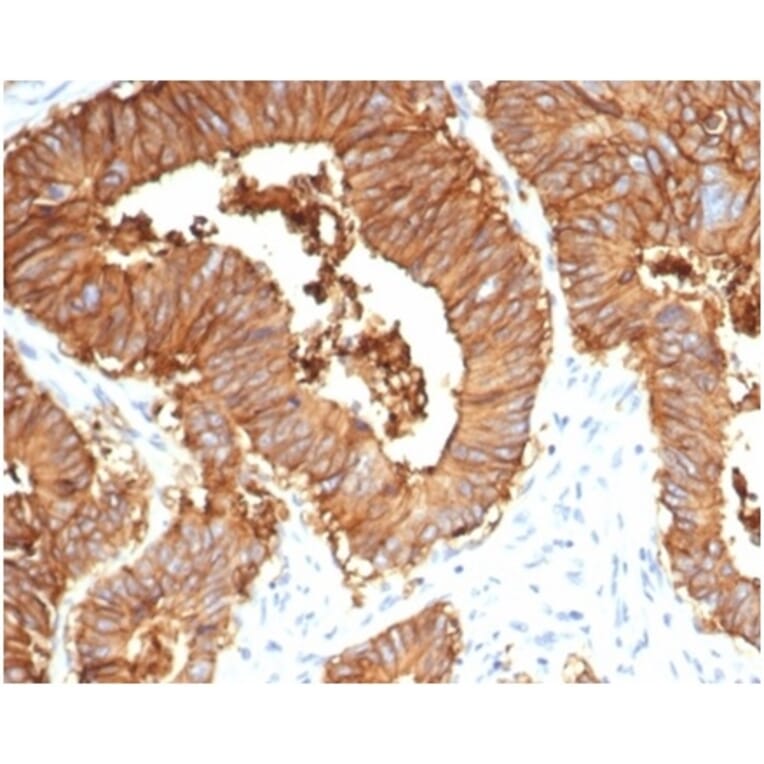 Immunohistochemistry - Anti-EpCAM Antibody [EGP40/7035R] - BSA and Azide free (A278614) - Antibodies.com