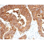 Immunohistochemistry - Anti-EpCAM Antibody [EGP40/7035R] - BSA and Azide free (A278614) - Antibodies.com