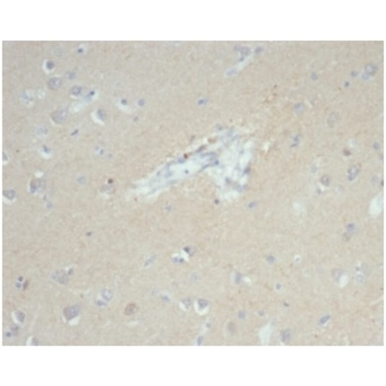 Immunohistochemistry - Anti-EpCAM Antibody [EGP40/7035R] - BSA and Azide free (A278614) - Antibodies.com