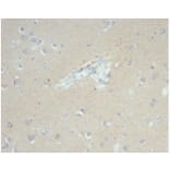 Immunohistochemistry - Anti-EpCAM Antibody [EGP40/7035R] - BSA and Azide free (A278614) - Antibodies.com