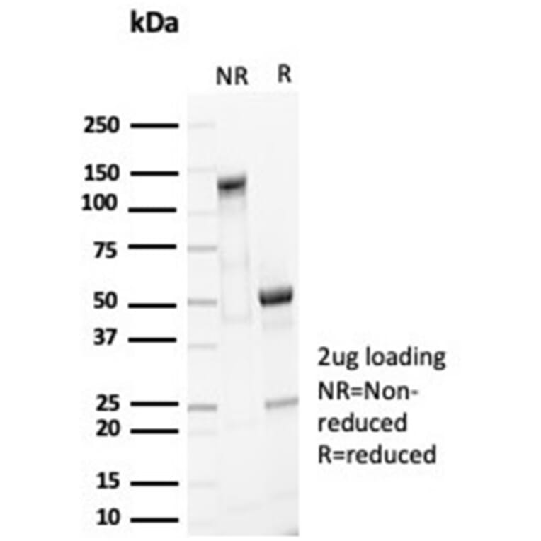 SDS-PAGE - Anti-EpCAM Antibody [EGP40/7035R] - BSA and Azide free (A278614) - Antibodies.com