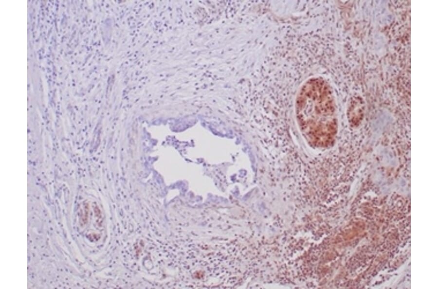 Immunohistochemistry - Anti-SMAD4 Antibody [SMAD/6309R] - BSA and Azide free (A278615) - Antibodies.com