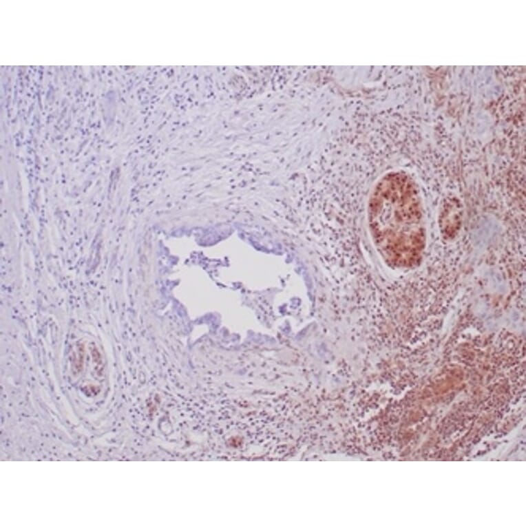 Immunohistochemistry - Anti-SMAD4 Antibody [SMAD/6309R] - BSA and Azide free (A278615) - Antibodies.com