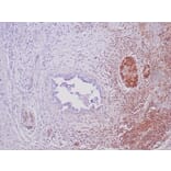 Immunohistochemistry - Anti-SMAD4 Antibody [SMAD/6309R] - BSA and Azide free (A278615) - Antibodies.com