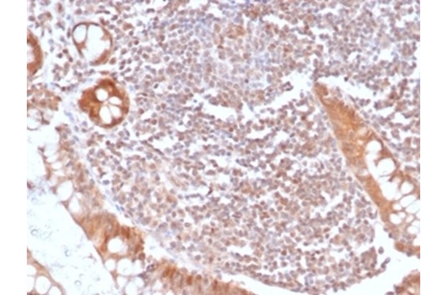 Immunohistochemistry - Anti-SMAD4 Antibody [SMAD/6309R] - BSA and Azide free (A278615) - Antibodies.com