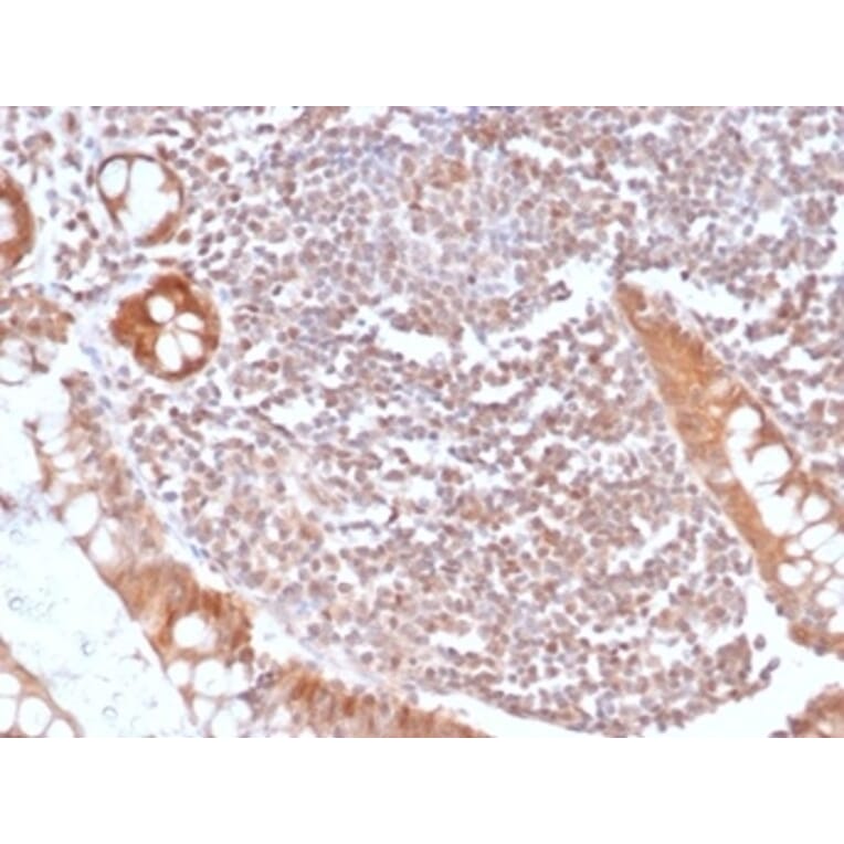 Immunohistochemistry - Anti-SMAD4 Antibody [SMAD/6309R] - BSA and Azide free (A278615) - Antibodies.com