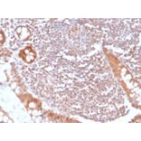 Immunohistochemistry - Anti-SMAD4 Antibody [SMAD/6309R] - BSA and Azide free (A278615) - Antibodies.com