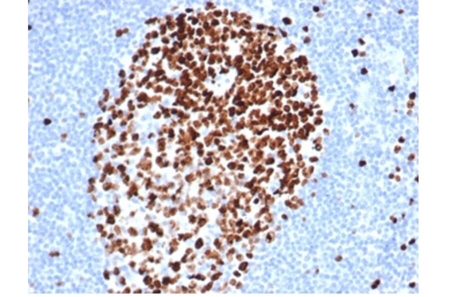 Immunohistochemistry - Anti-Ki67 Antibody [MKI67/4947R] - BSA and Azide free (A278616) - Antibodies.com