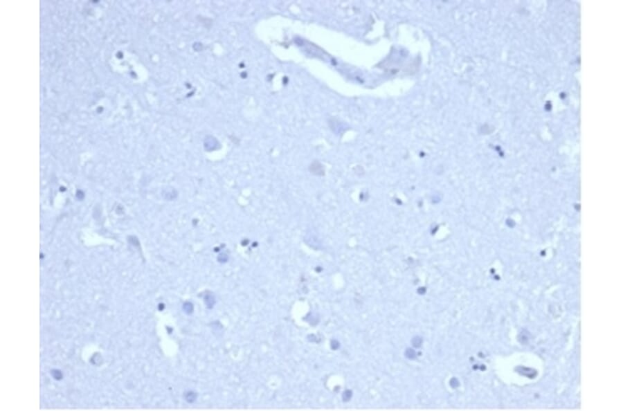 Immunohistochemistry - Anti-Ki67 Antibody [MKI67/4947R] - BSA and Azide free (A278616) - Antibodies.com