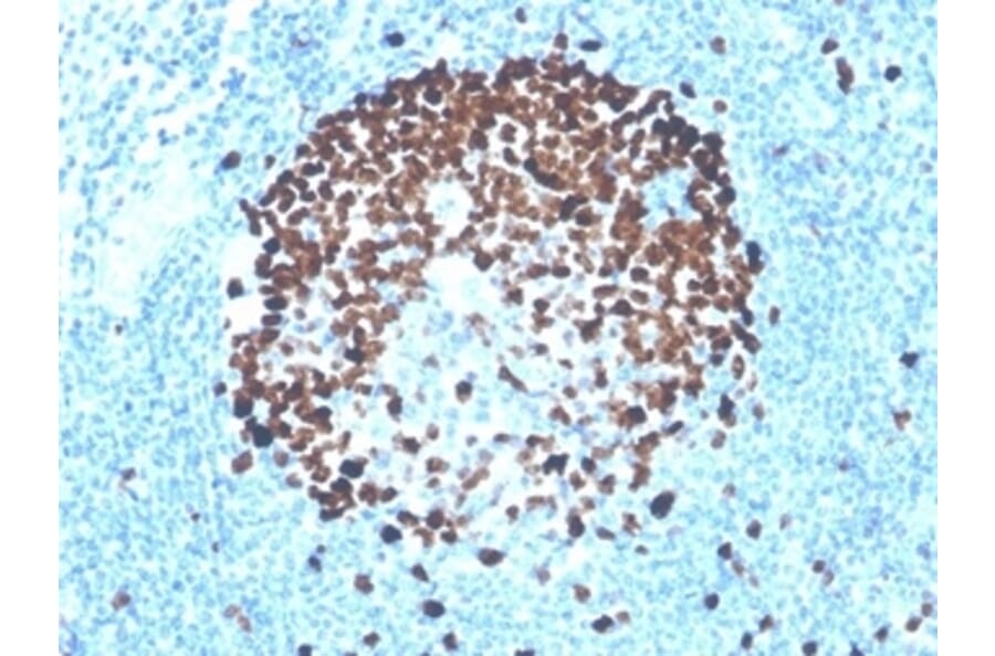 Immunohistochemistry - Anti-Ki67 Antibody [MKI67/4947R] - BSA and Azide free (A278616) - Antibodies.com