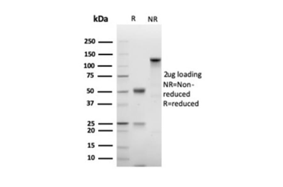SDS-PAGE - Anti-Ki67 Antibody [MKI67/4947R] - BSA and Azide free (A278616) - Antibodies.com