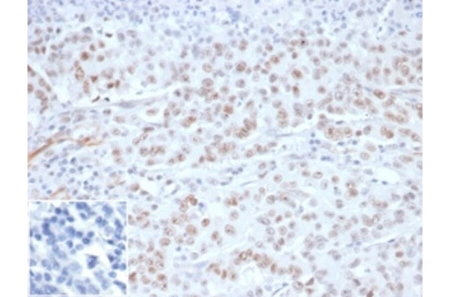 Immunohistochemistry - Anti-MLH1 Antibody [MLH1/6284R] - BSA and Azide free (A278617) - Antibodies.com