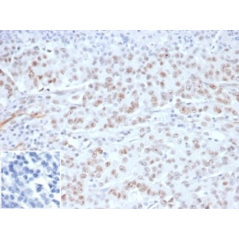 Immunohistochemistry - Anti-MLH1 Antibody [MLH1/6284R] - BSA and Azide free (A278617) - Antibodies.com