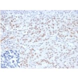 Immunohistochemistry - Anti-MLH1 Antibody [MLH1/6284R] - BSA and Azide free (A278617) - Antibodies.com