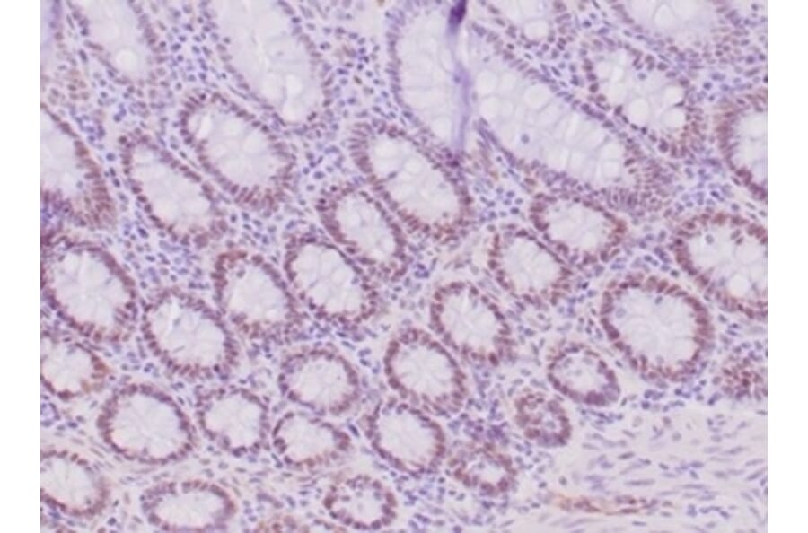 Immunohistochemistry - Anti-MLH1 Antibody [MLH1/6284R] - BSA and Azide free (A278617) - Antibodies.com