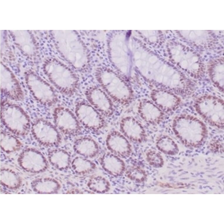 Immunohistochemistry - Anti-MLH1 Antibody [MLH1/6284R] - BSA and Azide free (A278617) - Antibodies.com