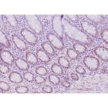 Immunohistochemistry - Anti-MLH1 Antibody [MLH1/6284R] - BSA and Azide free (A278617) - Antibodies.com