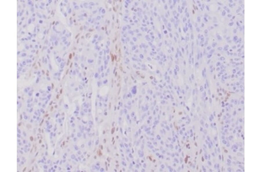 Immunohistochemistry - Anti-MLH1 Antibody [MLH1/6284R] - BSA and Azide free (A278617) - Antibodies.com