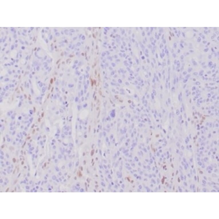 Immunohistochemistry - Anti-MLH1 Antibody [MLH1/6284R] - BSA and Azide free (A278617) - Antibodies.com