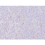 Immunohistochemistry - Anti-MLH1 Antibody [MLH1/6284R] - BSA and Azide free (A278617) - Antibodies.com