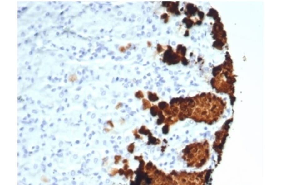 Immunohistochemistry - Anti-Mucin 5AC Antibody [MUC5AC/7067R] - BSA and Azide free (A278620) - Antibodies.com