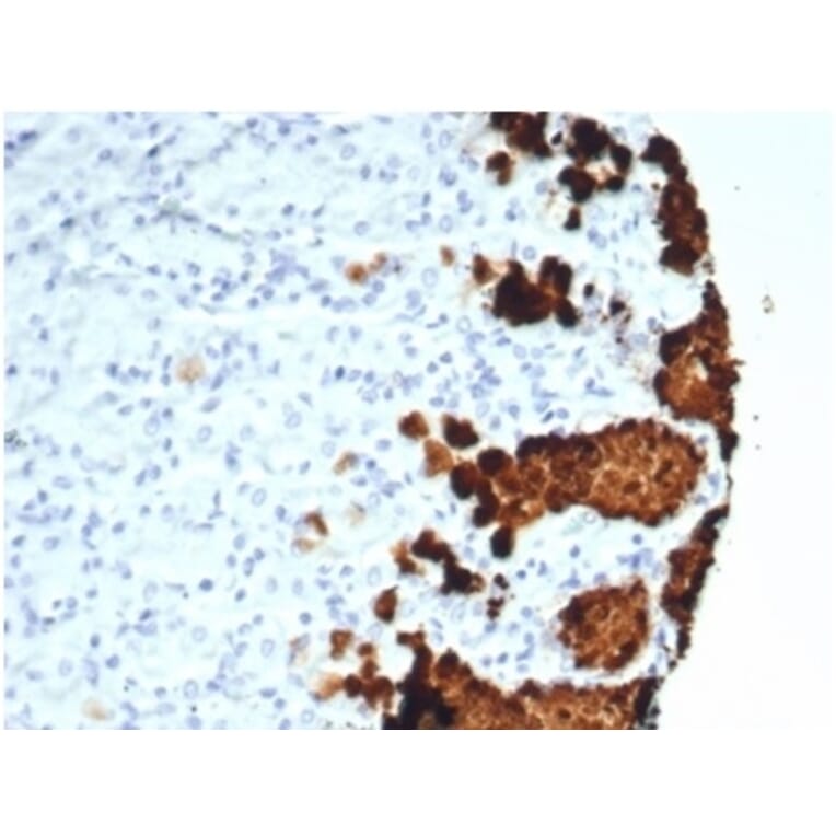 Immunohistochemistry - Anti-Mucin 5AC Antibody [MUC5AC/7067R] - BSA and Azide free (A278620) - Antibodies.com