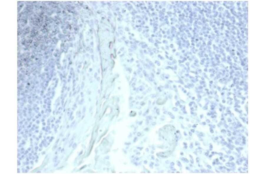 Immunohistochemistry - Anti-Mucin 5AC Antibody [MUC5AC/7067R] - BSA and Azide free (A278620) - Antibodies.com