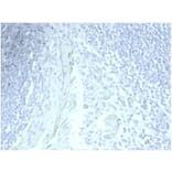 Immunohistochemistry - Anti-Mucin 5AC Antibody [MUC5AC/7067R] - BSA and Azide free (A278620) - Antibodies.com