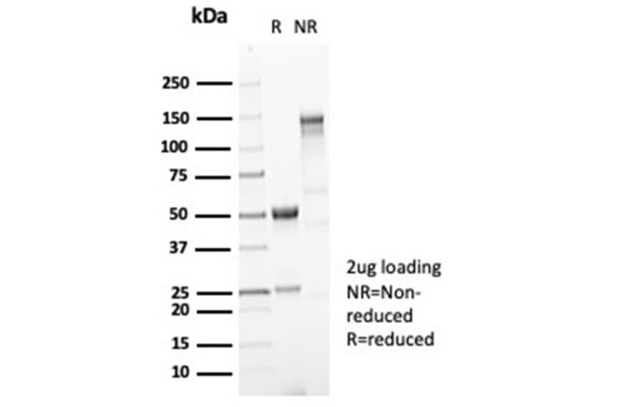 SDS-PAGE - Anti-Mucin 5AC Antibody [MUC5AC/7067R] - BSA and Azide free (A278620) - Antibodies.com