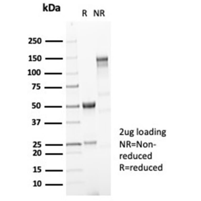 SDS-PAGE - Anti-Mucin 5AC Antibody [MUC5AC/7067R] - BSA and Azide free (A278620) - Antibodies.com