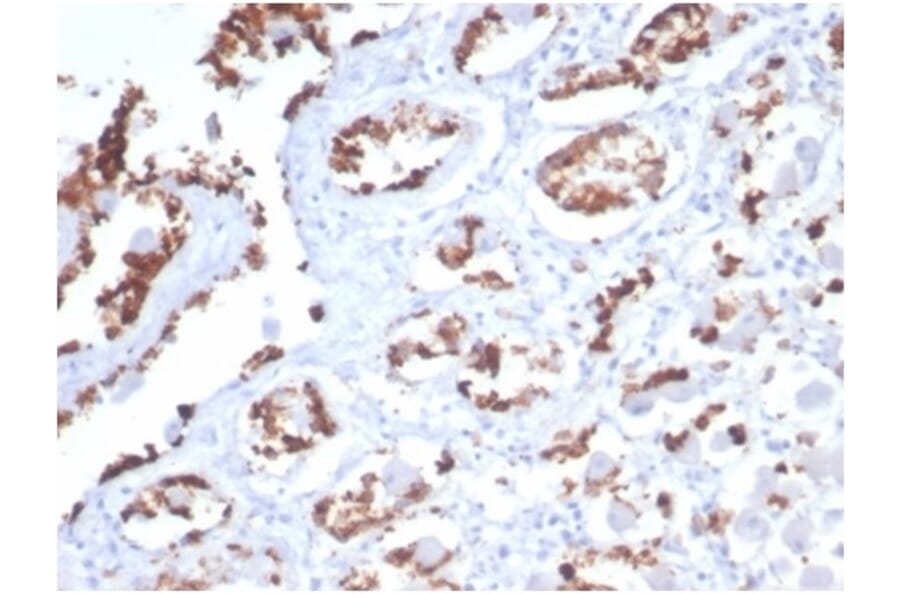 Immunohistochemistry - Anti-Mucin 5AC Antibody [MUC5AC/7068R] - BSA and Azide free (A278621) - Antibodies.com