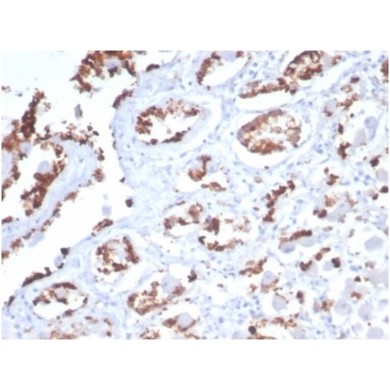Immunohistochemistry - Anti-Mucin 5AC Antibody [MUC5AC/7068R] - BSA and Azide free (A278621) - Antibodies.com