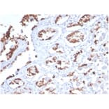 Immunohistochemistry - Anti-Mucin 5AC Antibody [MUC5AC/7068R] - BSA and Azide free (A278621) - Antibodies.com