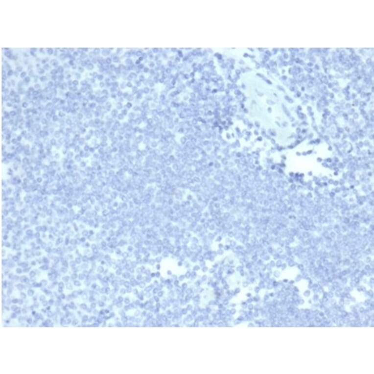 Immunohistochemistry - Anti-Mucin 5AC Antibody [MUC5AC/7068R] - BSA and Azide free (A278621) - Antibodies.com