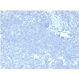 Immunohistochemistry - Anti-Mucin 5AC Antibody [MUC5AC/7068R] - BSA and Azide free (A278621) - Antibodies.com