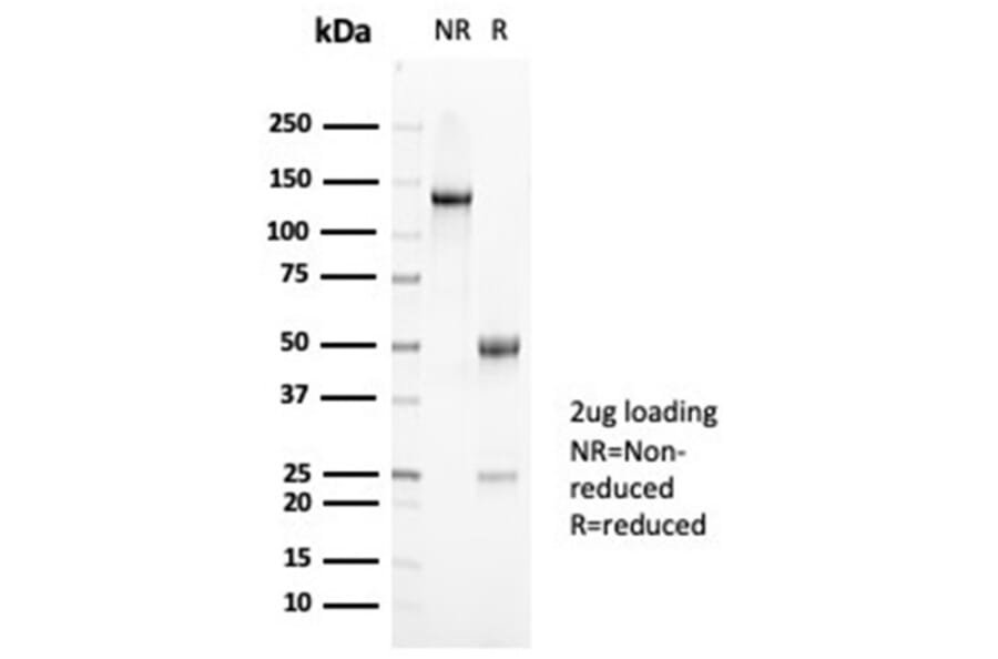 SDS-PAGE - Anti-Mucin 5AC Antibody [MUC5AC/7068R] - BSA and Azide free (A278621) - Antibodies.com