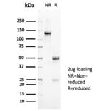 SDS-PAGE - Anti-Mucin 5AC Antibody [MUC5AC/7068R] - BSA and Azide free (A278621) - Antibodies.com