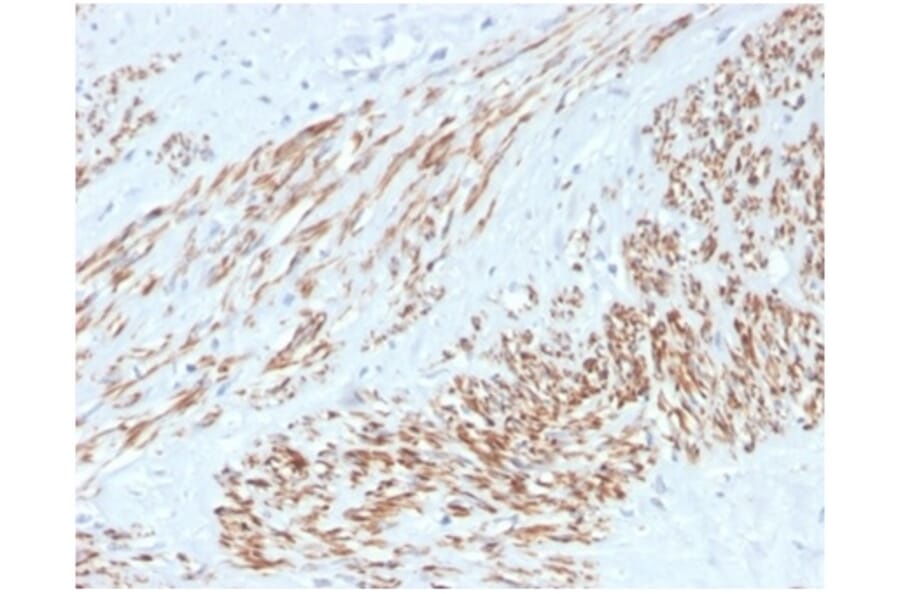 Immunohistochemistry - Anti-MYH11 Antibody [MYH11/4337R] - BSA and Azide free (A278622) - Antibodies.com