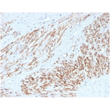 Immunohistochemistry - Anti-MYH11 Antibody [MYH11/4337R] - BSA and Azide free (A278622) - Antibodies.com