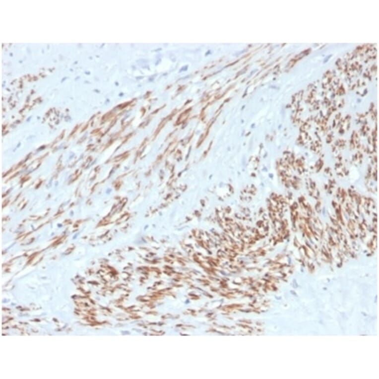 Immunohistochemistry - Anti-MYH11 Antibody [MYH11/4337R] - BSA and Azide free (A278622) - Antibodies.com