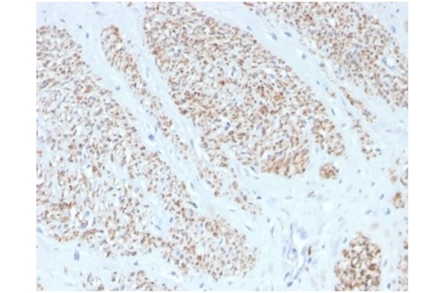 Immunohistochemistry - Anti-MYH11 Antibody [MYH11/4337R] - BSA and Azide free (A278622) - Antibodies.com