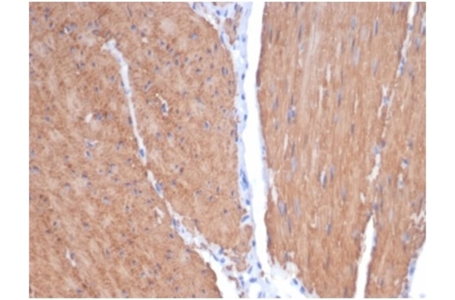 Immunohistochemistry - Anti-MYH11 Antibody [MYH11/7087R] - BSA and Azide free (A278623) - Antibodies.com