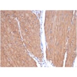 Immunohistochemistry - Anti-MYH11 Antibody [MYH11/7087R] - BSA and Azide free (A278623) - Antibodies.com