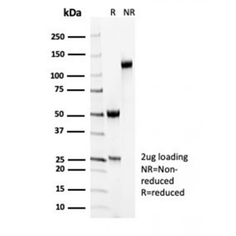 SDS-PAGE - Anti-MYH11 Antibody [MYH11/7087R] - BSA and Azide free (A278623) - Antibodies.com