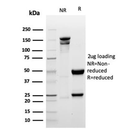 SDS-PAGE - Anti-Myogenin Antibody [MYOG/6298R] - BSA and Azide free (A278624) - Antibodies.com