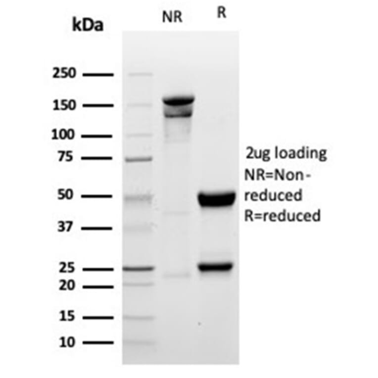 SDS-PAGE - Anti-Myogenin Antibody [MYOG/6298R] - BSA and Azide free (A278624) - Antibodies.com