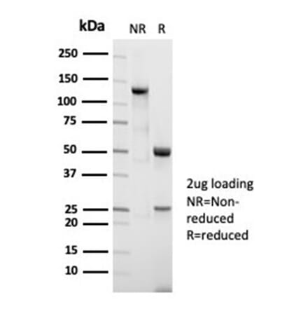 SDS-PAGE - Anti-Nucleolin Antibody [NCL/7014R] - BSA and Azide free (A278625) - Antibodies.com