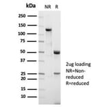 SDS-PAGE - Anti-Nucleolin Antibody [NCL/7014R] - BSA and Azide free (A278625) - Antibodies.com