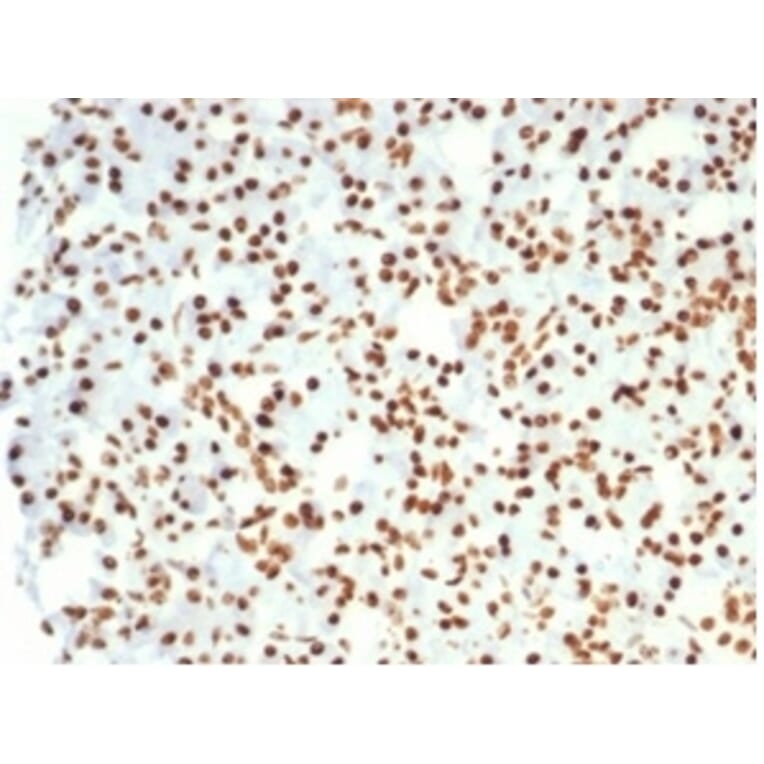 Immunohistochemistry - Anti-Nucleolin Antibody [NCL/7014R] - BSA and Azide free (A278625) - Antibodies.com