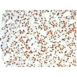 Immunohistochemistry - Anti-Nucleolin Antibody [NCL/7014R] - BSA and Azide free (A278625) - Antibodies.com